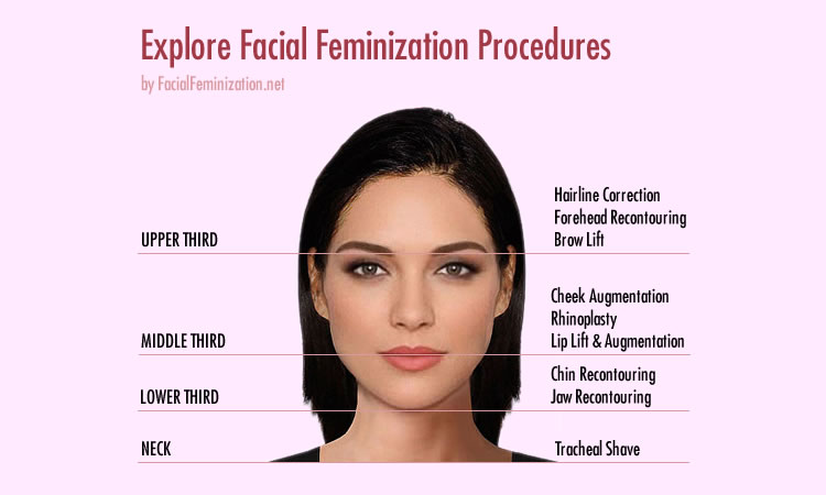 Facial feminization dr
